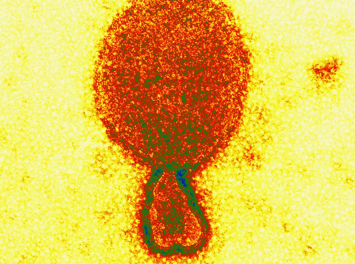 Zdjęcie mikroskopowe wirusa Hendra &#8211; innego z henipawirusów
